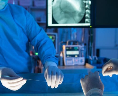 Venous Stent Surgery | Venous Stenting Medical Malpractice